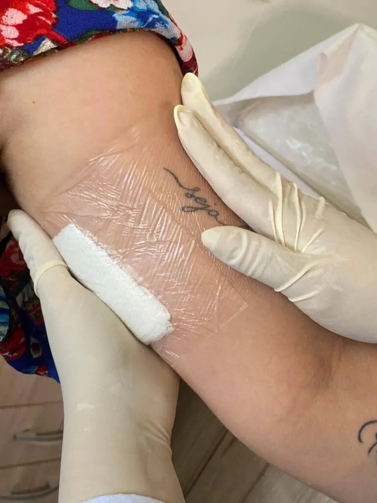 Implante Contraceptivo – Gvitta Educação